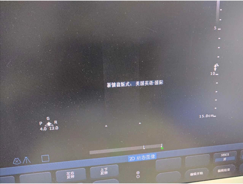 philips color ultrasound cx30 color ultrasound maintenance